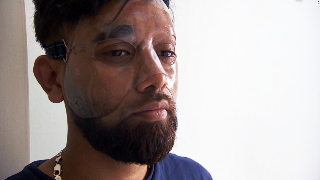 Is It An Offensive To Throw Battery Acid At Someone?